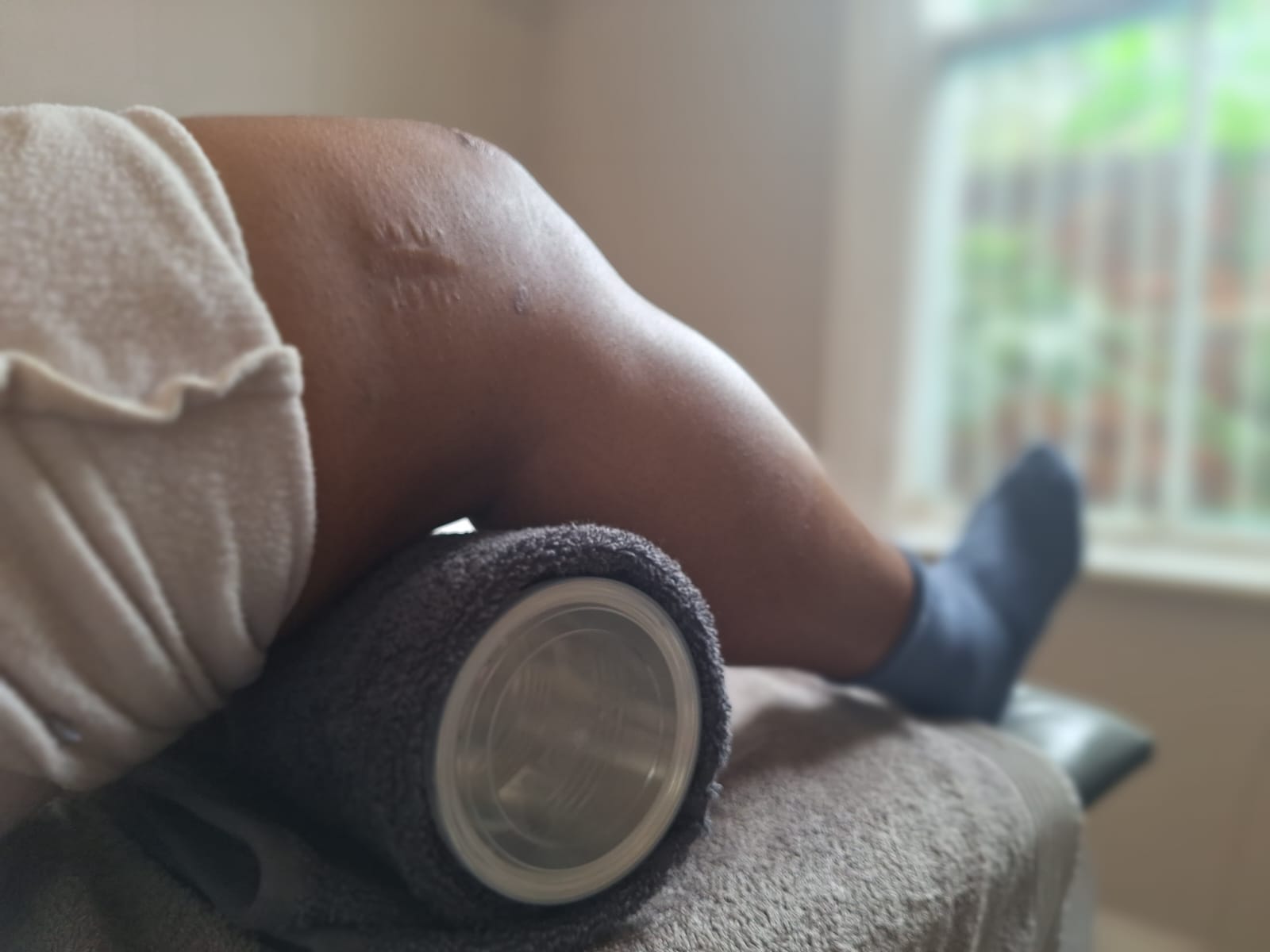 Post-operative physiotherapy — physiotherapy at Ludolf & Lienkie Physiotherapists, Kimberley